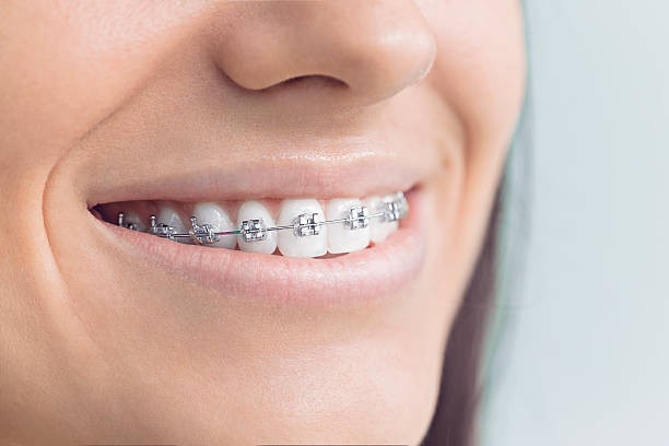 Best Traditional Braces  in Montrose, MI